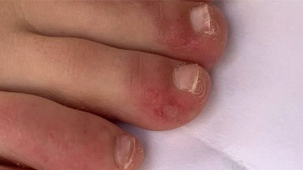 Tailandda jinsiy eskort