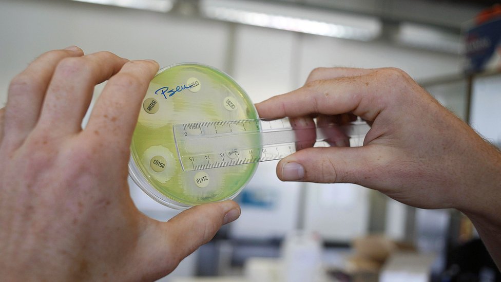 Bacterias