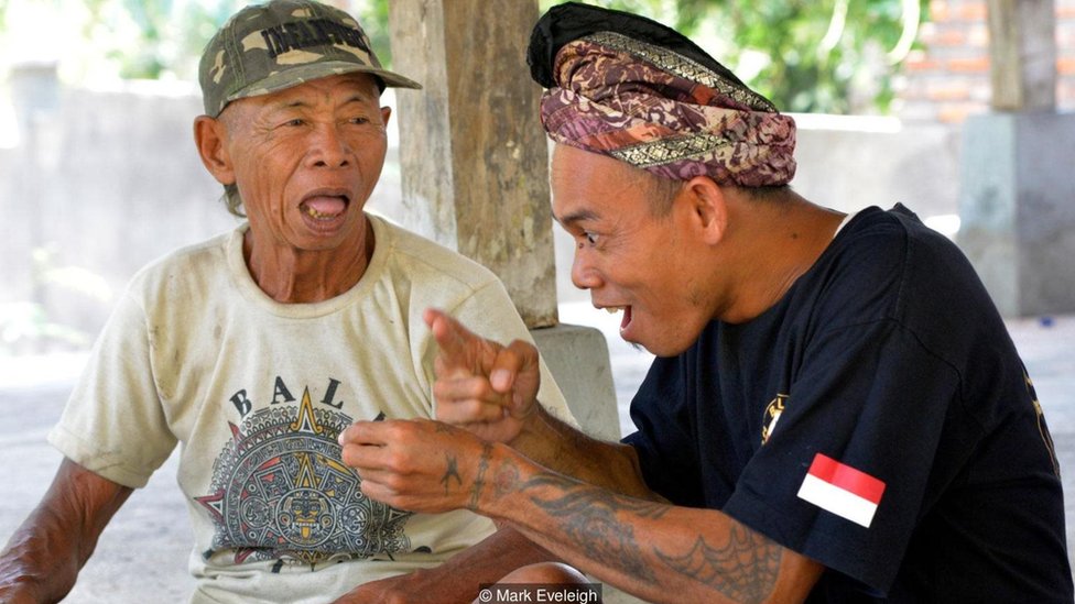 Vakuumli nipellar fotosurati