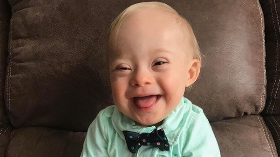 Lucas Warren tiene 18 meses y con síndrome de Down. (Foto: Gerber)