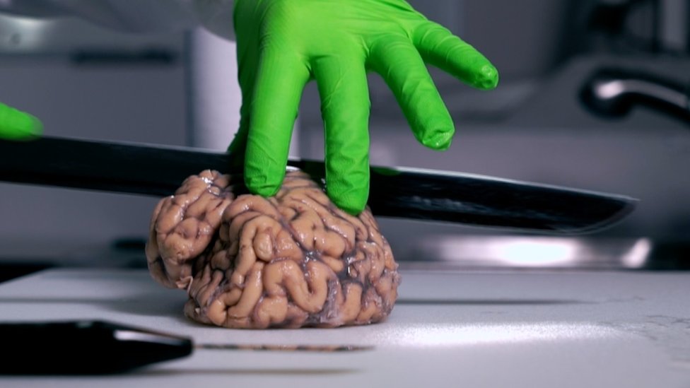 Cutting brain for research