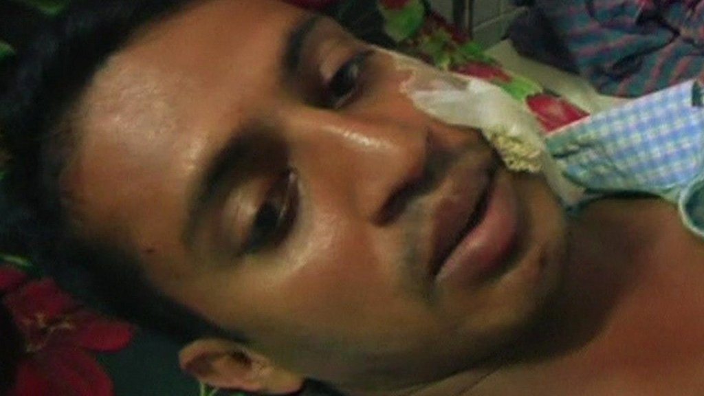 Video image