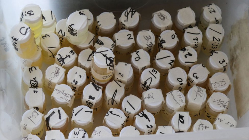 Dikdagi katta dumba suratlari