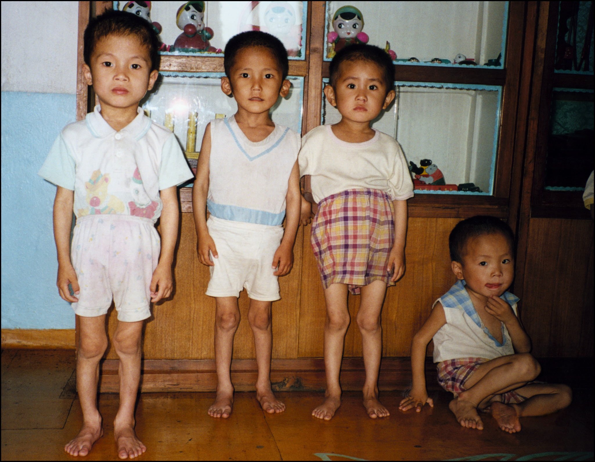 Niños desnutridos en Corea del Norte