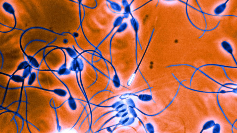 Анальды раушандар