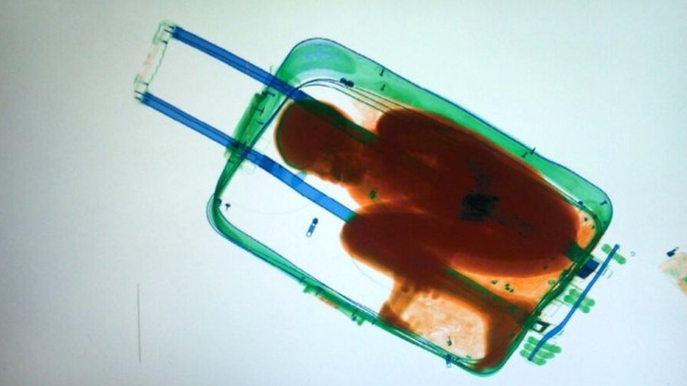 Sinar xray