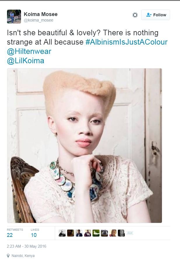 Albino model
