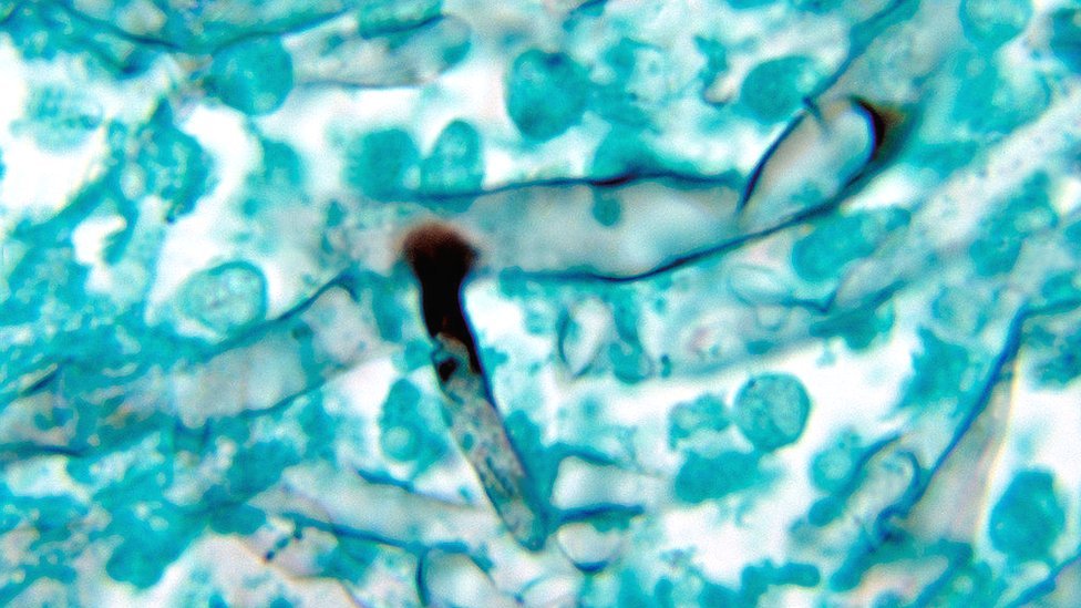 Fotosuratlarda Bokudagi fohishalar Fotosuratlarda Bokudagi fohishalar