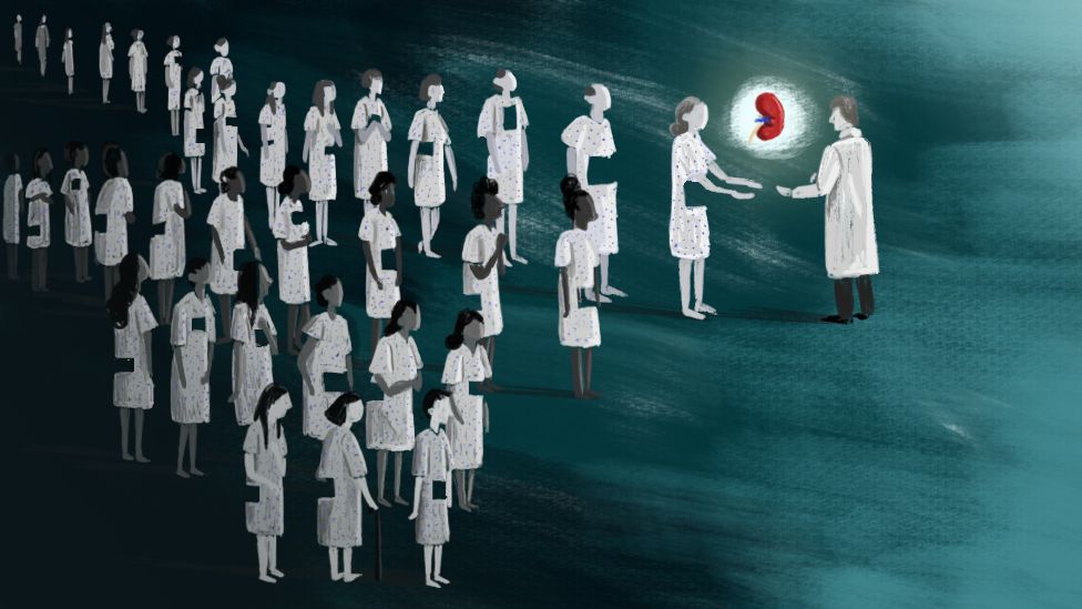 Una ilustración muestra a donantes blancos dándole sus órganos a un médico, mientras que la fila de donantes negro no lo hace.