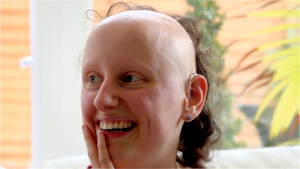 Alopecia: 'I can't control my hair loss'