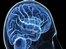 Autism self-diagnosis test developed