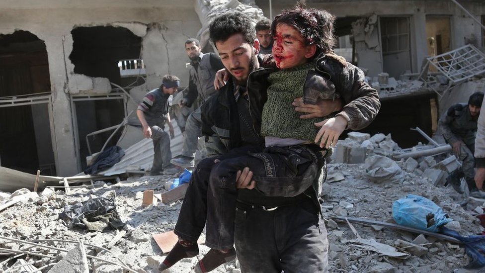 Un hombre lleva en brazos a un niño víctima de un ataque en Guta Oriental, Damasco, Siria.