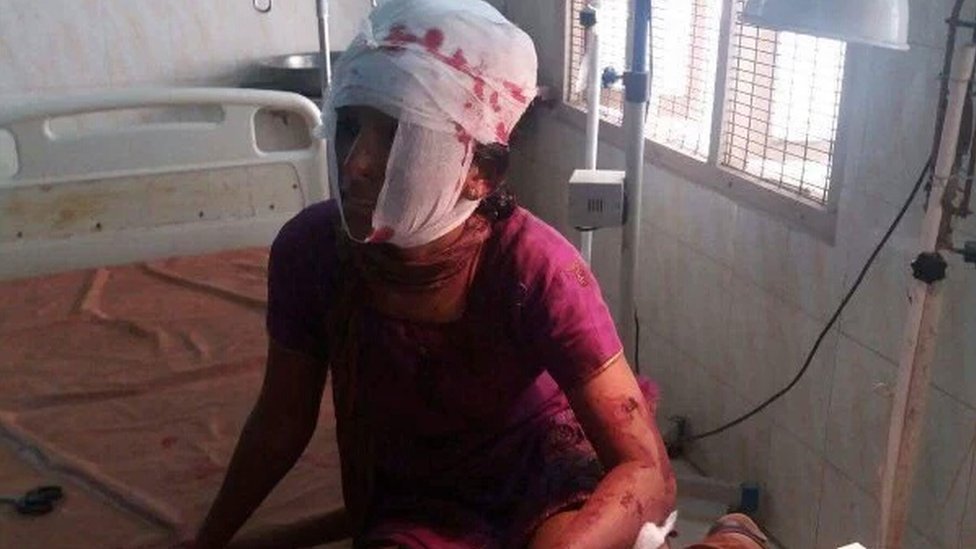 Kausalya herida en el hospital.