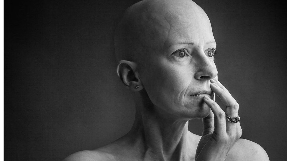 Soqoldan sperma oqib tushgan uy qurilishi fotosuratlari