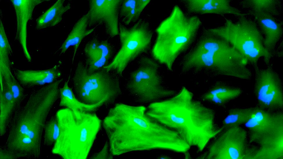 Atrocitos derivados de células madre neurales humanas. Los astrocitos son cruciales para la función cerebral correcta. (Wellcome Images)
