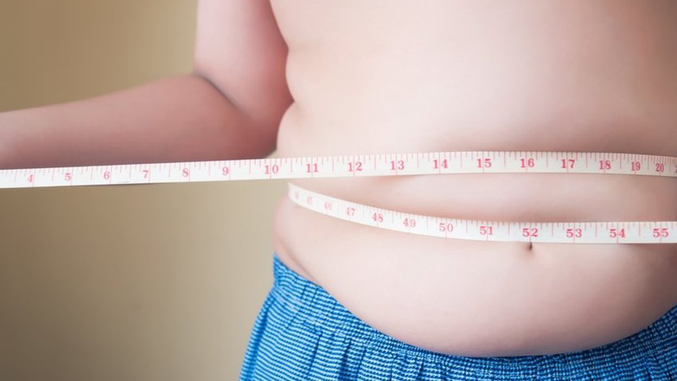 Obesidade infantil: as razões por trás do aumento de peso entre as crianças  brasileiras - BBC News Brasil