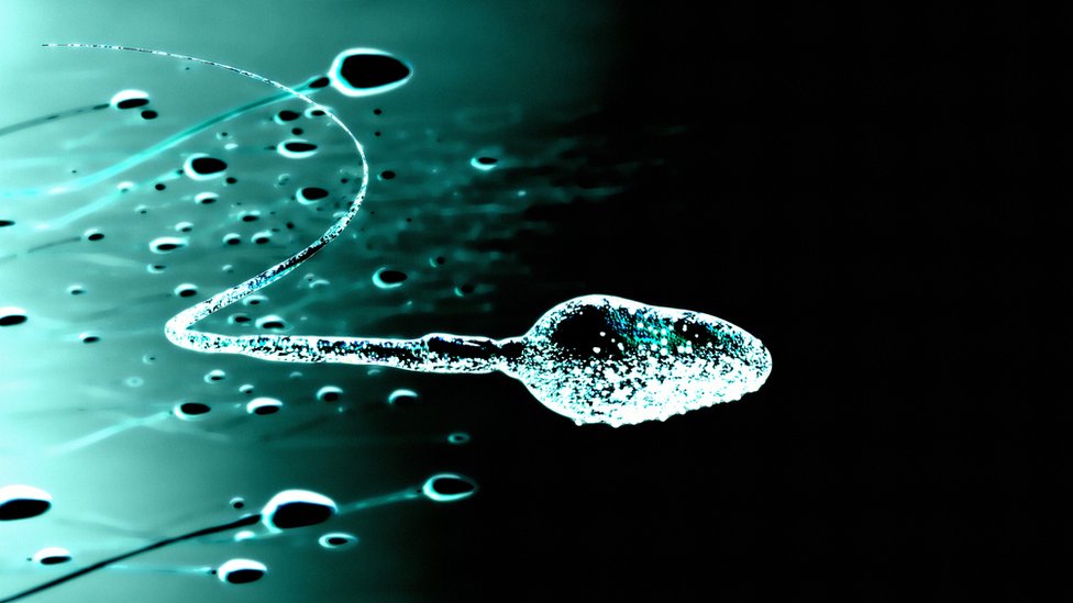 Густая сперма - причина появления изменений? | Клиника Радуга
