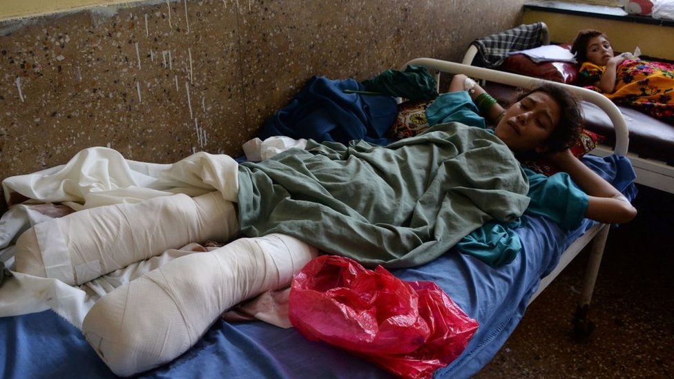 فتاة أفغانية مصابة