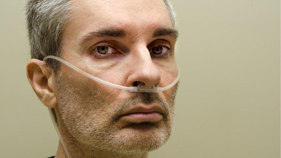 Hombre con ayuda respiratoria.