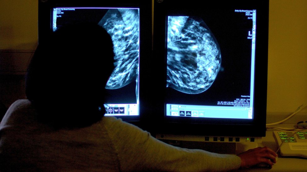Key cancer waiting target set to be missed in England