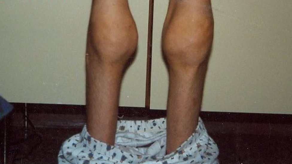 Piernas
