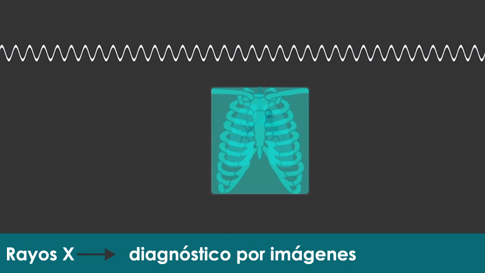 Gráfico
