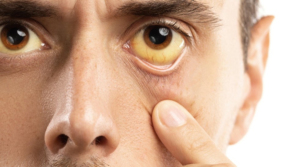 Lo que tus ojos pueden revelar de tu salud - BBC News Mundo