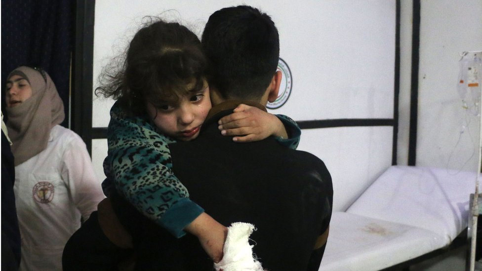 Un pequeña herida en Douma, Siria