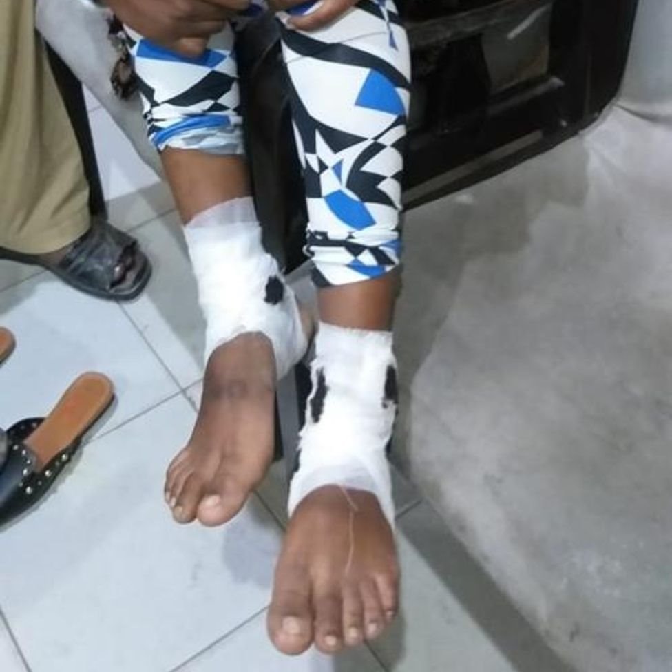 Yalangoch qizlarning yuqori aniqlikdagi erotik fotosuratlari Gozal porno onlayn HD formatda tomosha qiling