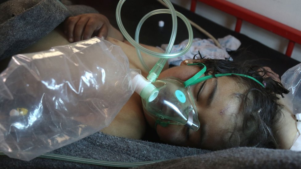 File photo taken on 4 April 2017 shows a Syrian child receiving treatment at a hospital in the town of Maarat al-Numan following a suspected Sarin attack in Khan Sheikhoun