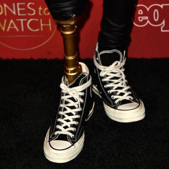 Wesser desarrolló una gangrena en la pierna derecha que hizo necesaria una amputación. Pies de Lauren Wasser, modelo y activista