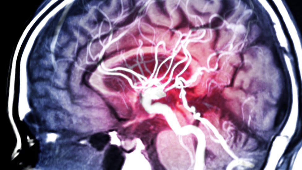 Imagem de ressonância magnética do cérebro humano
