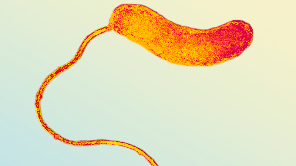 Se encuentra fácil y no ataca nuestras células ni las de las plantas. Bdellovibrio