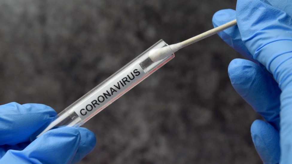 Koronavirüs testi