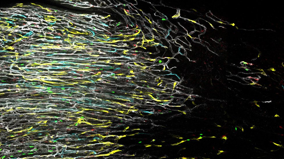 Изображение сети кровеносных сосудов в сердце мыши