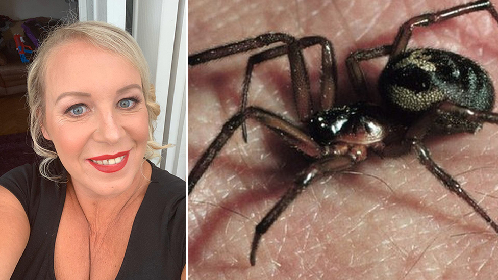 Black Widow Spider Bite Pictures Day 2 ConnieHemby