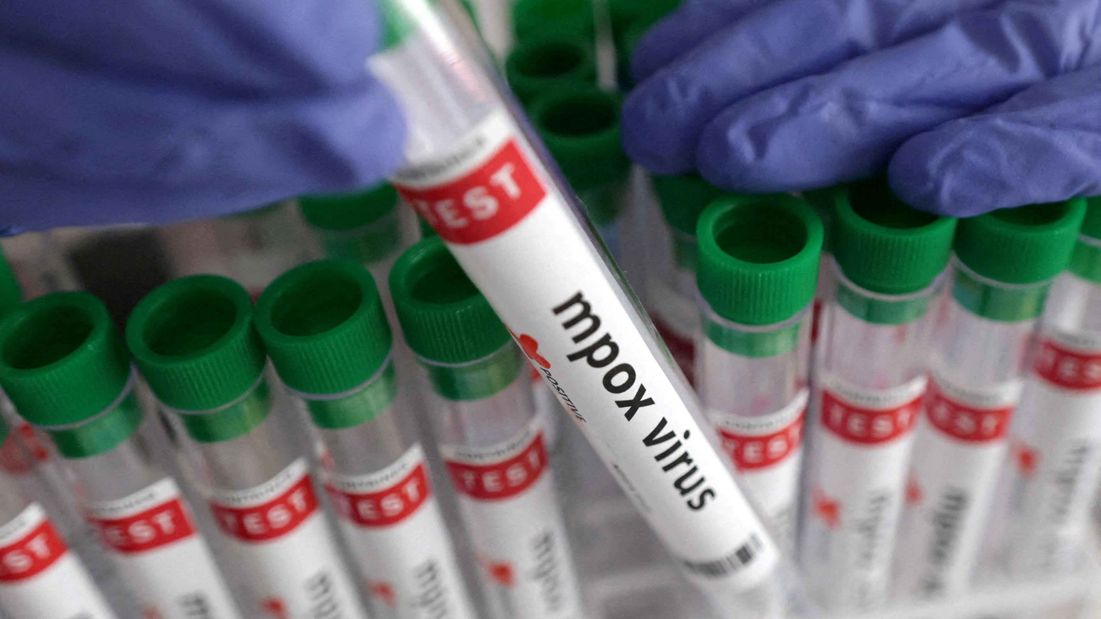 Northern Ireland Records Significant Rise in Mpox Cases as Public Health Agency Issues Guidance
