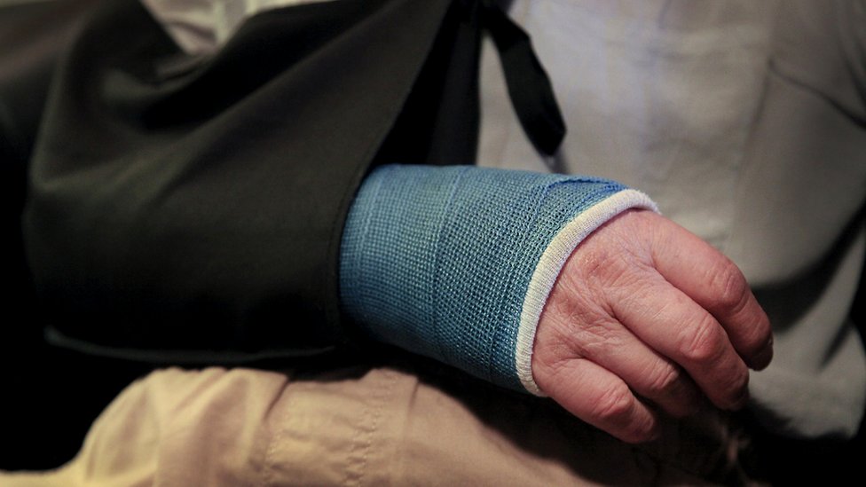 La fisioterapia puede ayudar a recuperar la rotura, pero a veces es necesaria la intervención quirúrgica. Brazo vendado de hombre