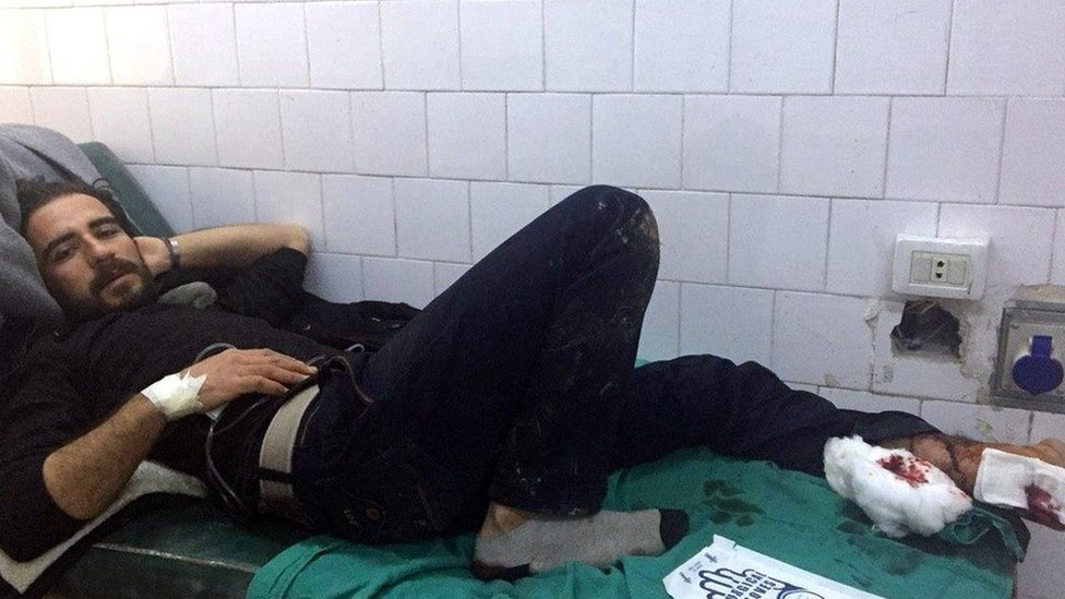 По сообщениям, мужчина, раненный в столкновениях с американскими войсками на северо-востоке Сирии, лежит на больничной койке (12 февраля 2020 г.)