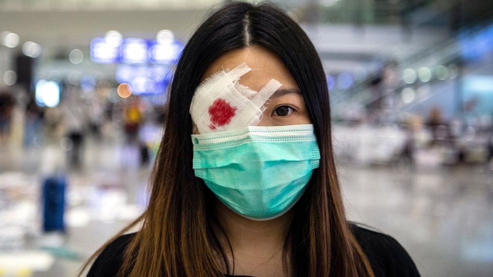 Протестующий носит имитацию повязки на глазу, когда протестующие занимают международный аэропорт Гонконга в Гонконге, Китай, 13 августа 2019 года