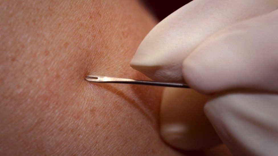 A needle is jabbed into a person's arm.