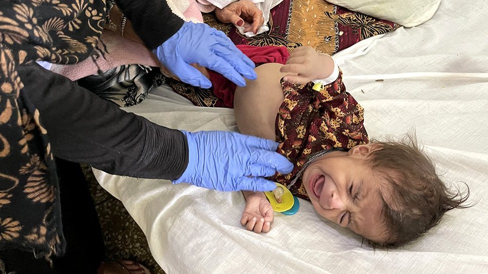 طفل يتلقى العلاج الطبي في مستشفى مير فيز في قندهار ، أفغانستان ، 28 أكتوبر/تشرين الأول 2021