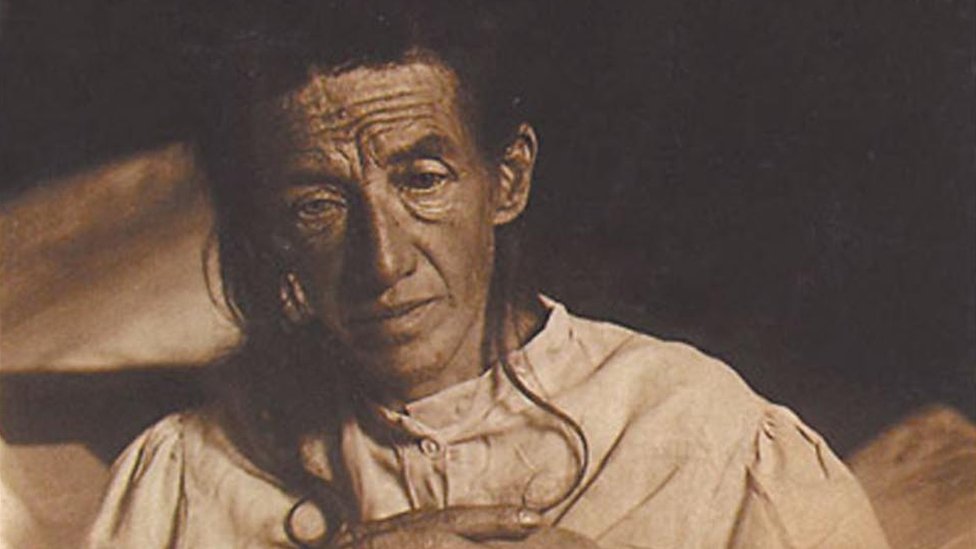 Auguste Deter, el ama de casa alemana que se convirtió en la primera paciente de Alzheimer del mundo. Imagen de dominio público.