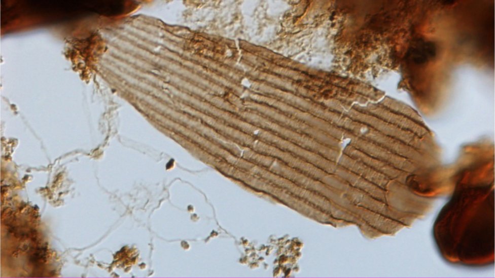 Así se ve la escama del ala bajo el miscroscopio. Foto: Bas van de Schootbrugge. Una de las escamas bajo el microscopio