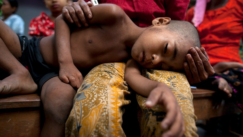 Boy with malaria lying with his head on his mother's lap