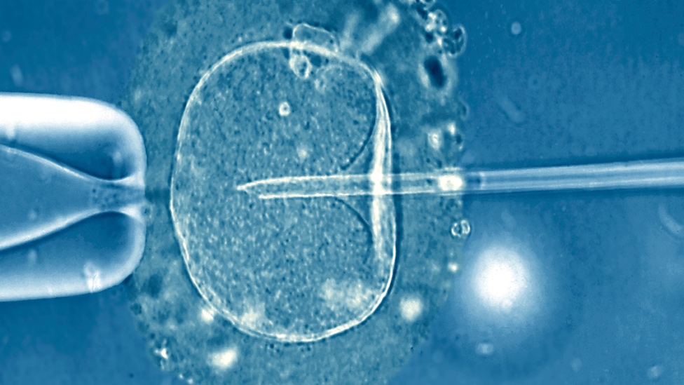 Inyección de un espermatozoide en un ovocito