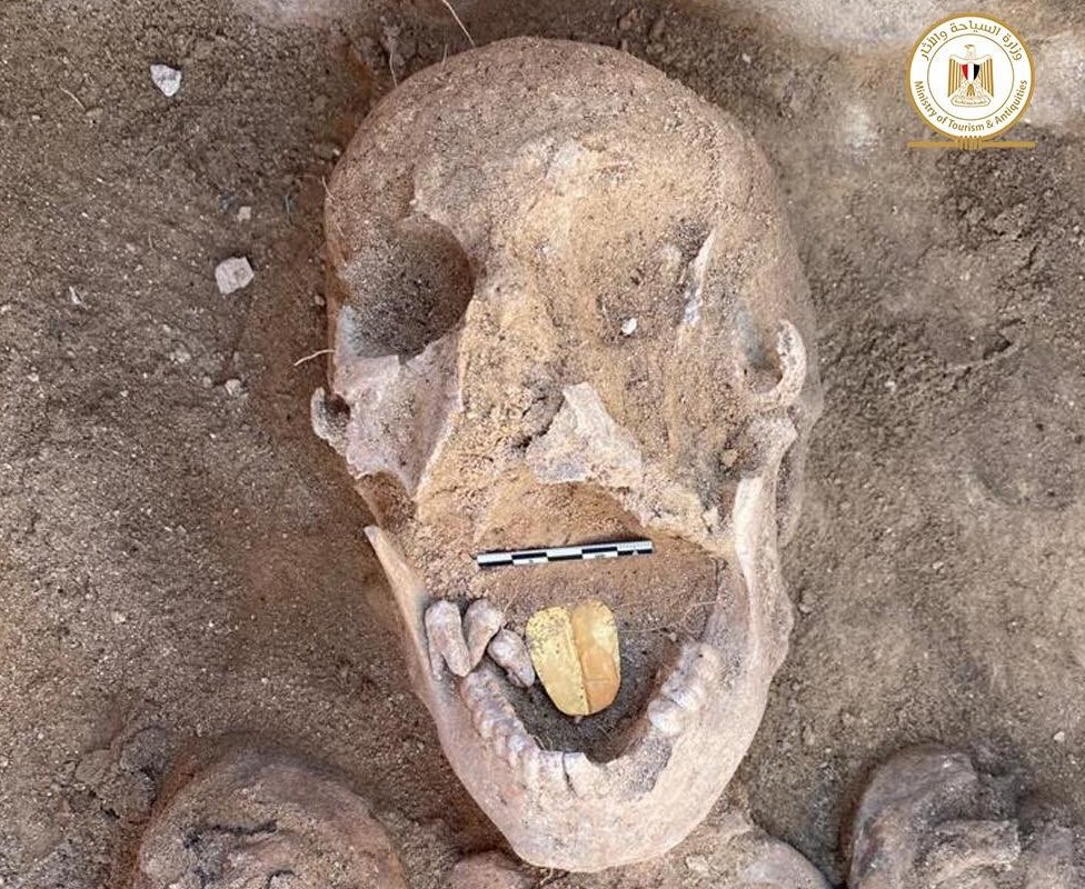 Restos de una momia egipcia antigua con una lengua dorada colocada dentro de su boca encontrados en el templo Taposiris Magna de Alejandría.