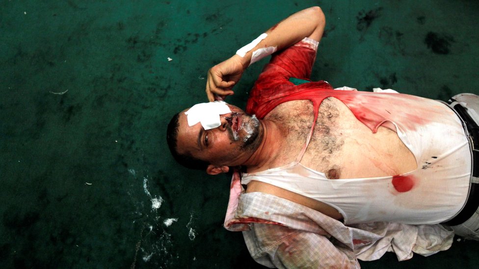 Ramses Meydanı'ndaki gösteride yaralanan bir Mursi destekçisi