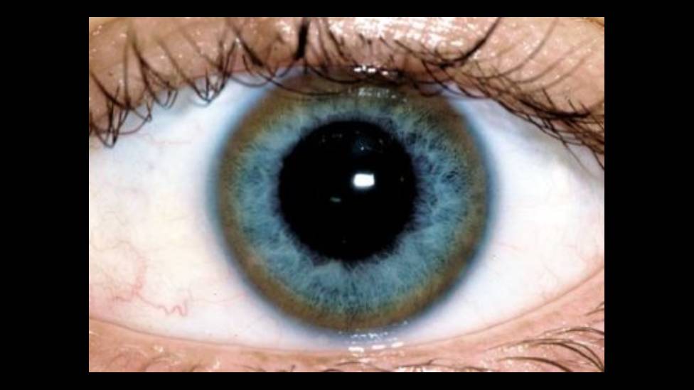 Foto macro de um olho com um aro cor de cobre ao redor do azul