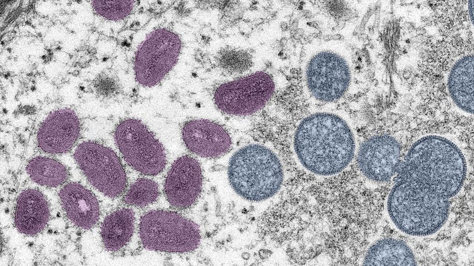 صورة مجهرية لفيروس جدري القرود